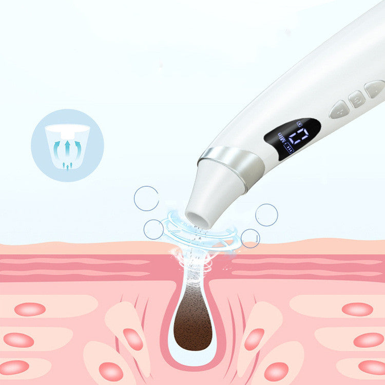 Ruza Electric Blackhead Remover