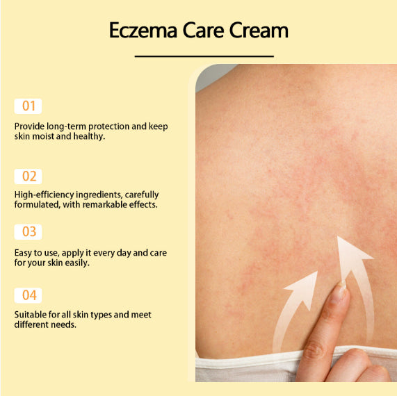 Ruza Eczema Relief Cream