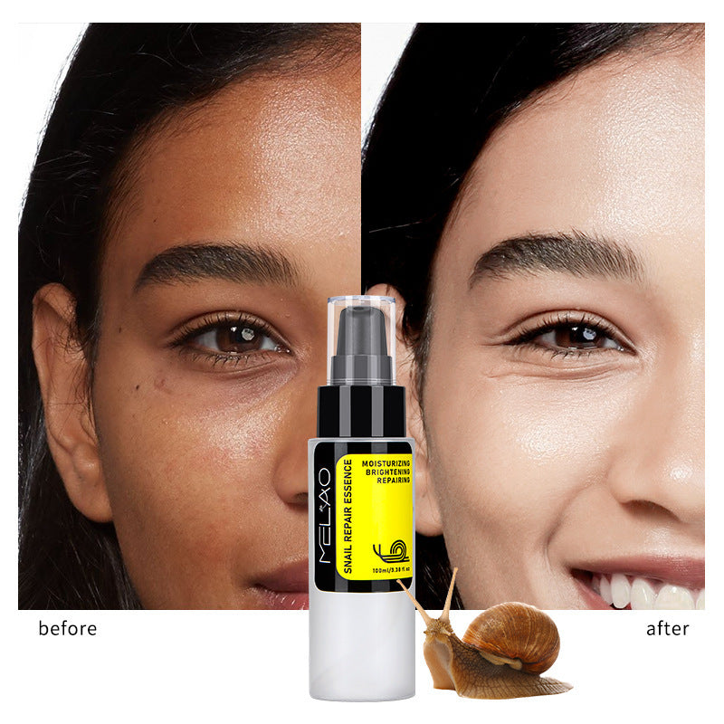 Ruza Snail Facial Care Solution