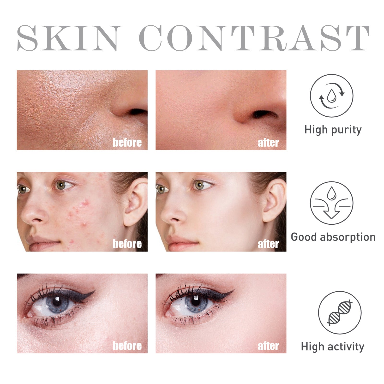 Ruza Salicylic Acne Repair Water