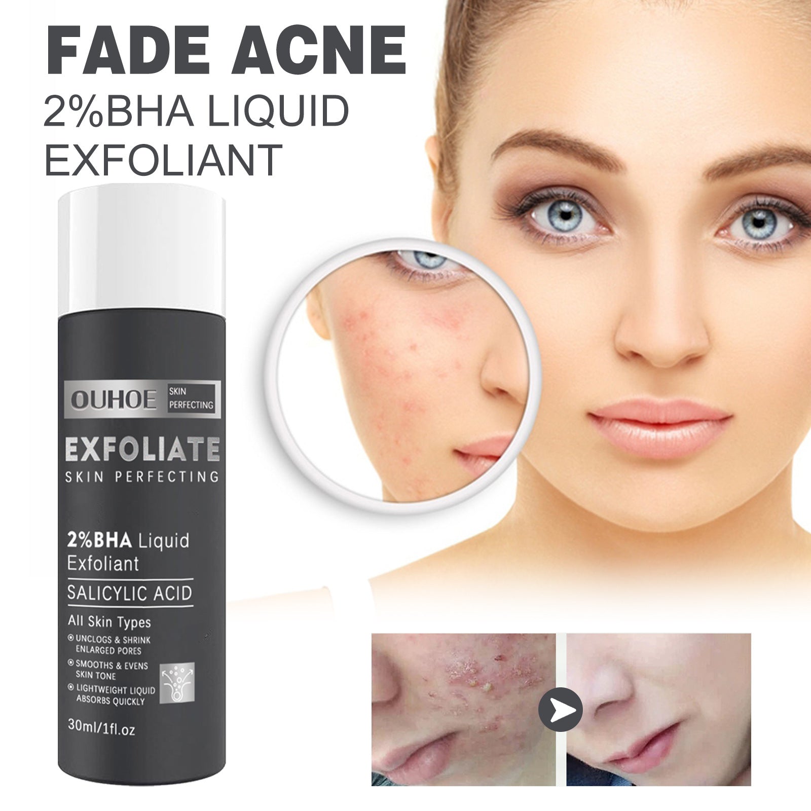 Ruza Salicylic Acne Repair Water