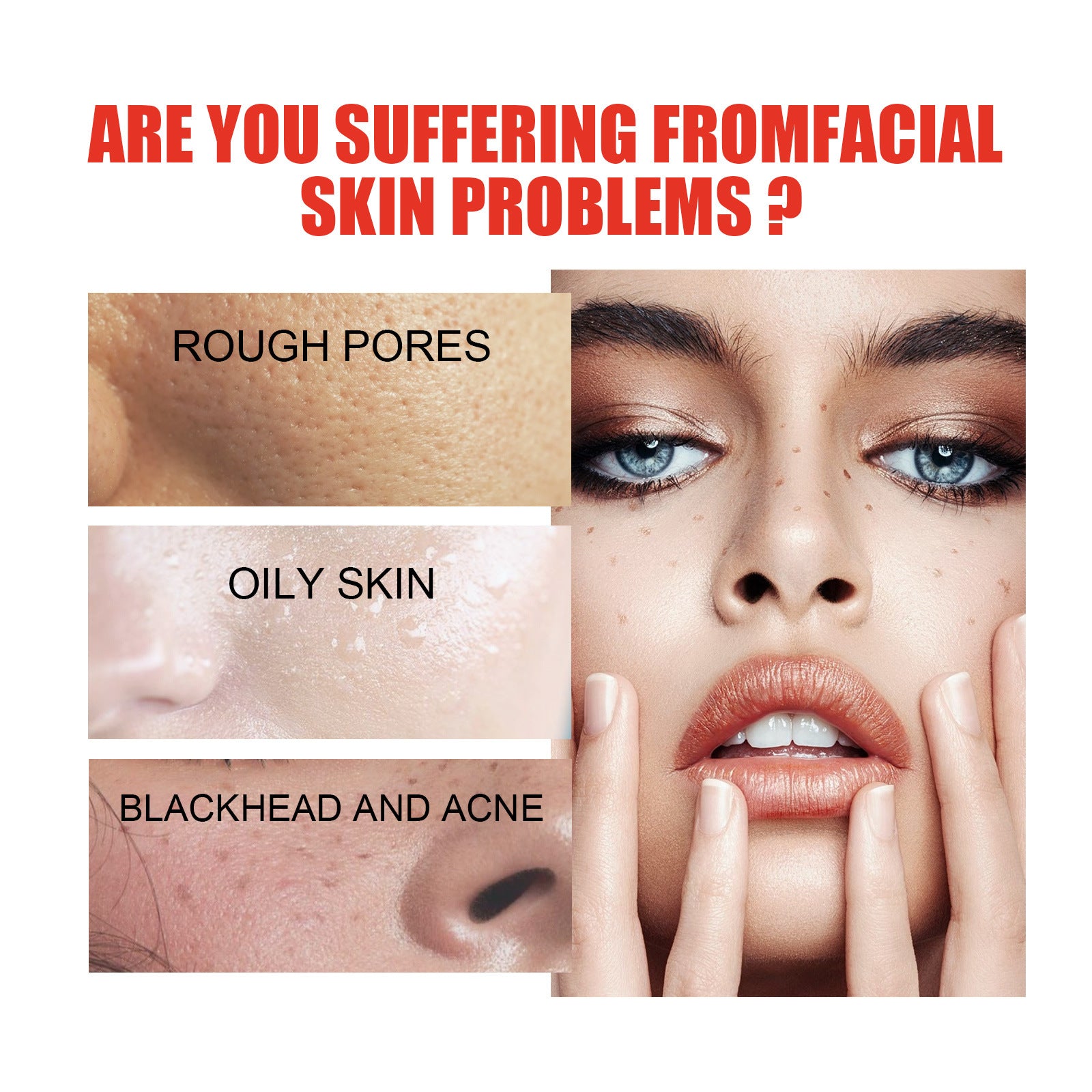 Tender Skin Care Solution