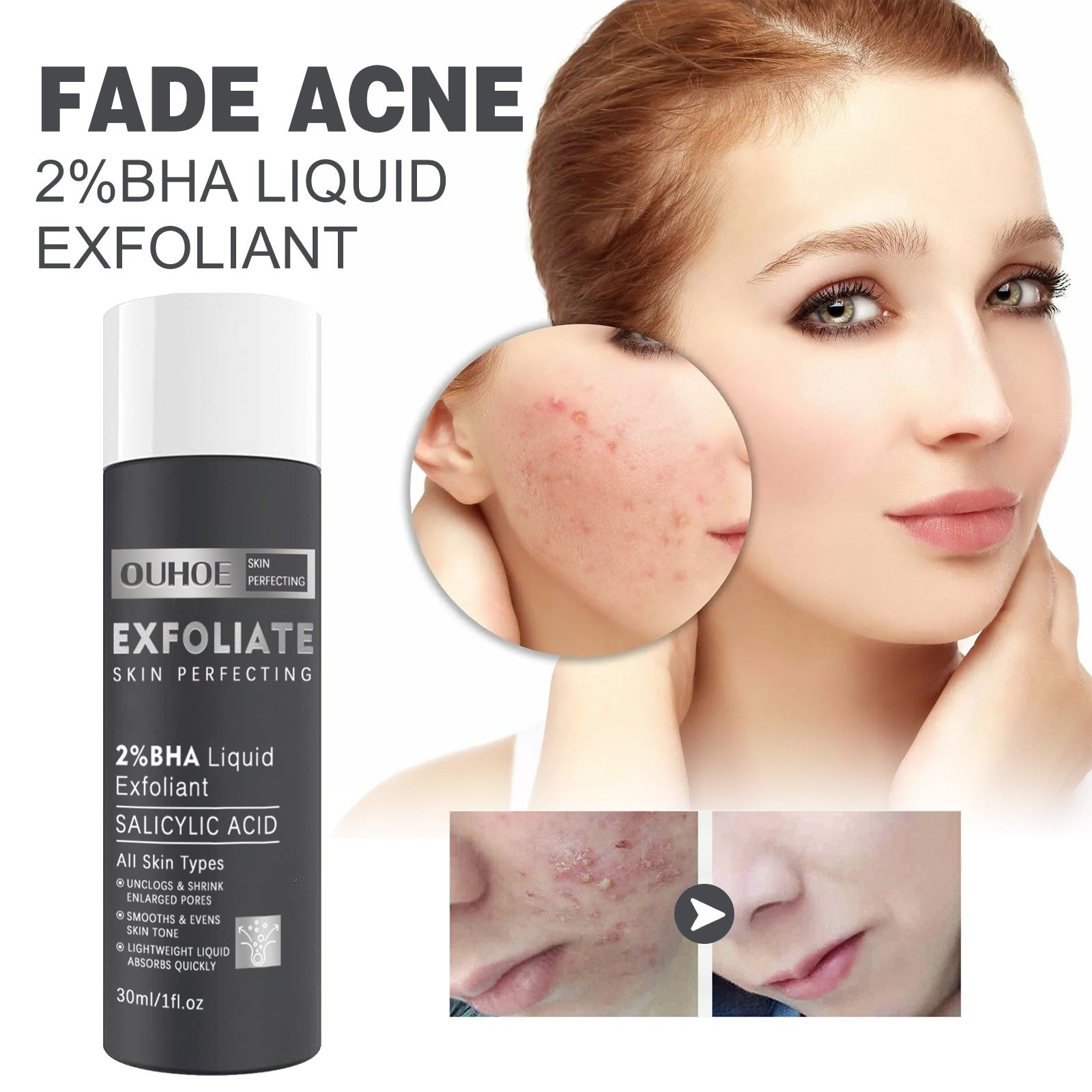 Ruza Salicylic Acne Repair Water